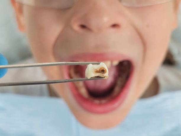 Best Emergency Dental Services for Seniors in Cedar Lake, IN